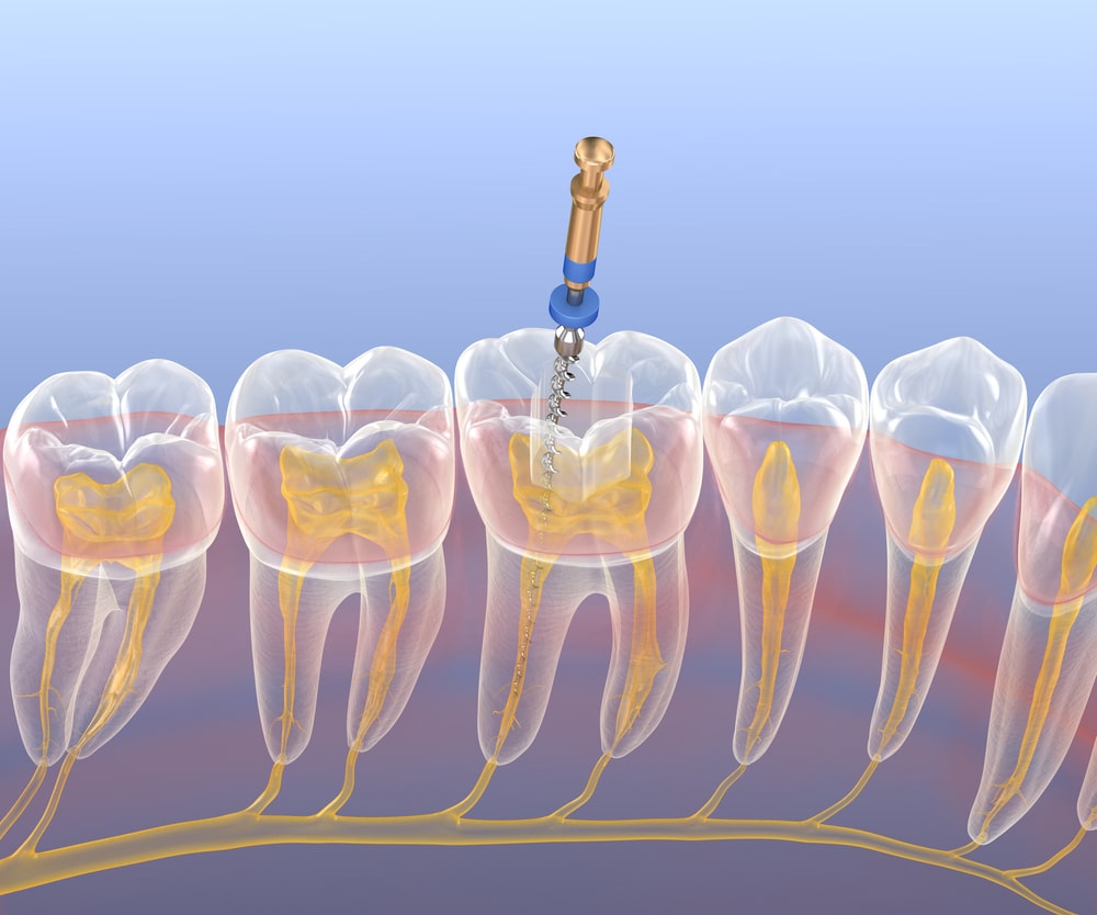 Endodontie